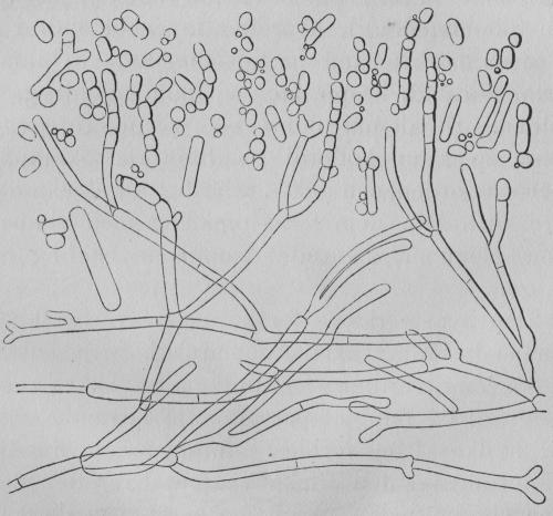 Bild 10. Mjölksvampen (Oidium lactis), 300 ggr förstorad.