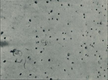 <smalFot. af A. C. Johansen.</smal<bFig. 29. Huller, frembragte af Sandmuslingen (Mya arenaria L.) paa Vaderne Vest for Tipperhalvøen.  Maj 1913.