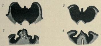 Textfig. 1—4. Paradoxurus hermaphrodiius; Perinealorgan 1—2 ♂; 3—4 ♀. <bQuerschnitte. 1, c. 20 mm, 2, c. 40 mm hinter der Präputialöffnung. 3, durch die Mitte der <bweiblichen Geschlechtsöffnung; 4, c. 15 mm hinter der weiblichen Geschlechtsöffnung. <bDrüsenfeld schwarz. Die das Organ umgebende Haut dunkelgrau. <bMuskelmantel des Organs etwas heller. Subcutanes Bindegewebe hellgrau. X 2.