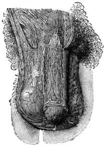 Fig. 12. Det yttre af manslemmen och pungen.<ba. ryggsidan af lemmen, b. ollonet, c. förhuden,<bd. urinrörsmynningen, e. upphängningsband,<bf. Venus-berget, g. ljumsk-kanalen (bråck-ringen), h.<bsädes-strängen, i. pungen, k. testikeln.