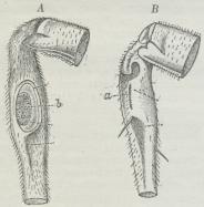 Fig 3. Øren af to forskellige Skovgræshopper<b(forstørret). I A ses et Forskinneben hos en Art, hvor<bTrommehinden b ligger frit; i B en Art, hvor kun<bSpalten a, der fører ind til Trommehinden, ses.