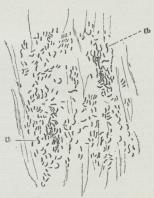 En Renkultur af<bKolerabakterie paa fugtigt Linned.<bMan ser mange »Kommabaciller«<b(a) og enkelte spirillignende.<b(Henved 600 Gange forst.).