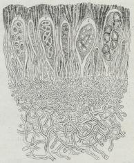Fig. 7. Lodret Snit gennem et Stykke af Sporelejet<baf Physcia cilioris. I fire Sporesække ses Sporer i<bforsk. Udviklingsgrad (1—4).