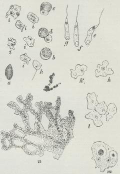 Fig. 1. Chondrioderma difforme. a Spore, b samme,<bopsvulmet, c og d spirende Sporer, e, f og g<bSværmsporer, h Sværmsporens Overgang til Myxoamøbe,<bi, k Myxoamøber, l Myxoamøber, liggende op til<bhinanden, kort før Sammensmeltningen, m et lille<bPlasmodie, n Gren af et udvokset Plasmodie.