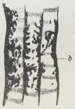 Fig. 7. Kariøs Nedbrydning<baf Emailleprismer. a<bPrisme, b Interprismatiske Rum<bmed Bakterier. (Stærkt<bforstørret, skematiseret).