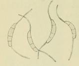 Fig. 3. Discosia Artocreas.<bKonidien. <su<smal1000</smal</su/<su<smal1</smal</su.