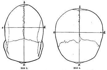 Bild 3. Hufvudskål af kaffer, sedd rätt uppifrån (i <su<smal1</smal</su/<su<smal3</smal</su storl. K. I. M.). Förhållandet mell.<blängdlinien ab och breddlinien cd angifver längdbreddförh. Denna hufvudskål är starkt dolikocefal.<bBild 4. Hufvudskål af en lill-ryss (i <su<smal1</smal</su/<su<smal3</smal</su storl. K. I. M.) är åter starkt brakycefal.