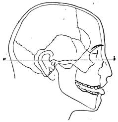 Bild 11. Hufvud af tysk (flicka) i ren profil (<su<smal1</smal</su/<su<smal3</smal</su storl.), i hvilket kraniet är intecknadt.<bEfter <span class= Bild 11. Hufvud af tysk (flicka) i ren profil (<su<smal1</smal</su/<su<smal3</smal</su storl.), i hvilket kraniet är intecknadt.<bEfter <span class=