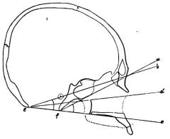 Bild 14. Hufvudskål af malaj, i sagittal genomskärning (<su<smal1</smal</su/<su<smal3</smal</su storl.). Samma vinklar som å<bbild 13 äro här angifna; de visa en betydligt olika storlek å de båda hufvudskålarna. K. 1. M.