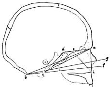 Bild 16. Hufvudskål af svensk (man), i sagittal genomskärning <su<smal1</smal</su/<su<smal3</smal</su storl.) m. tillh. ac<bär kraniebasens längd, adc <span class=