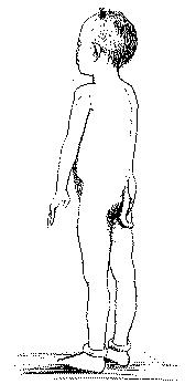 Fig. 256.