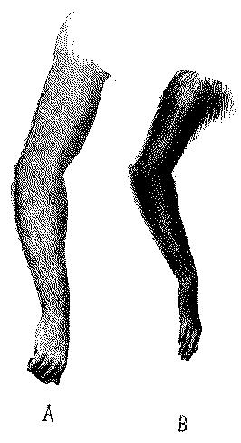 Fig. 260.